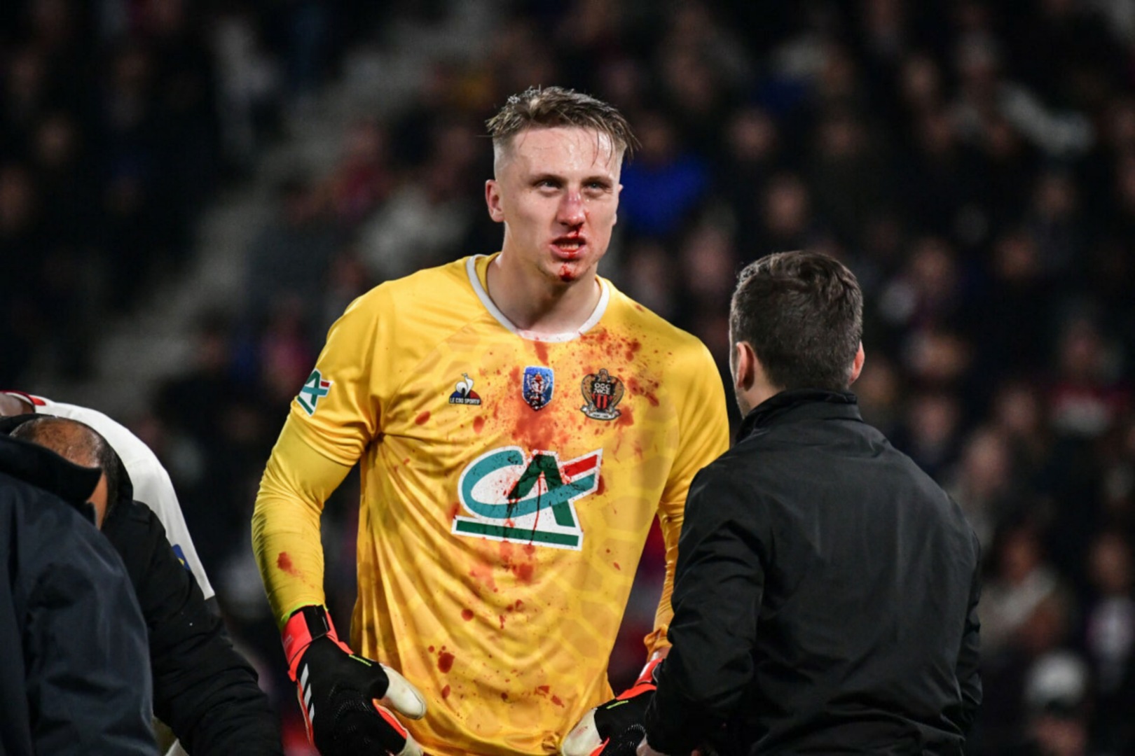 满冠体育直播- 法国杯尼斯VS红星 